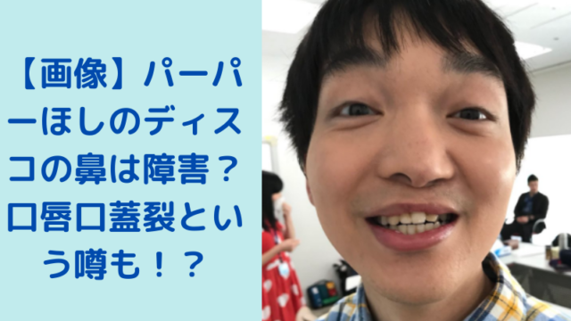 画像 ののかちゃん 左目は斜視で手術や矯正で治る 怖いという声も 村方乃々佳 Trend Diary